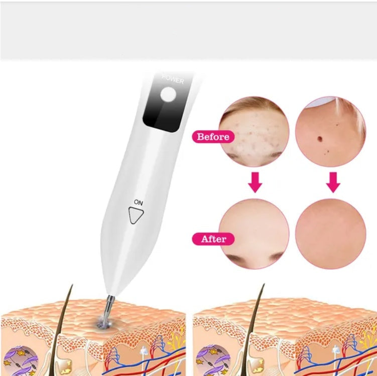 rechargeable mole remover